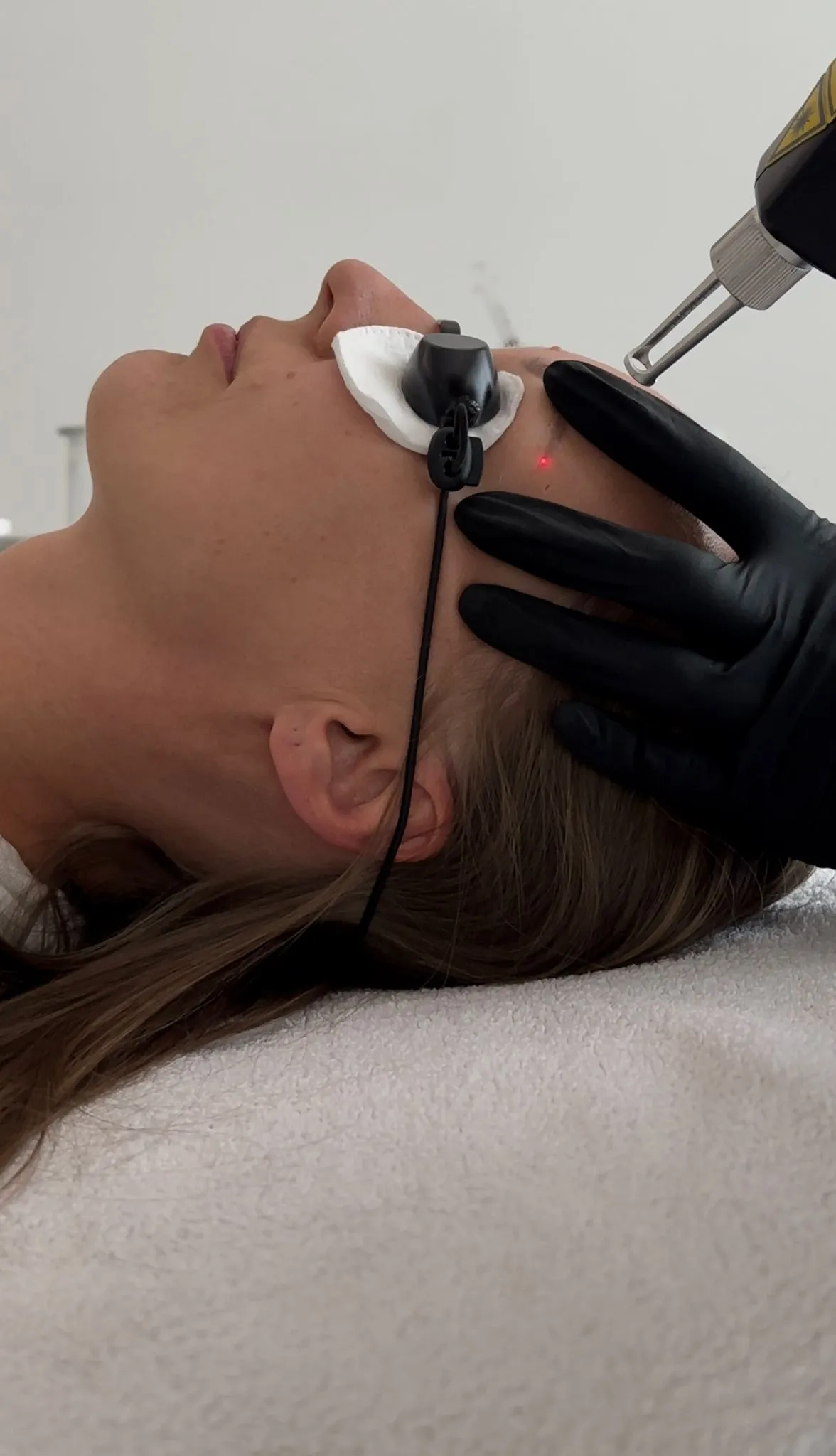 lasersko-skidanje-trajne-sminke